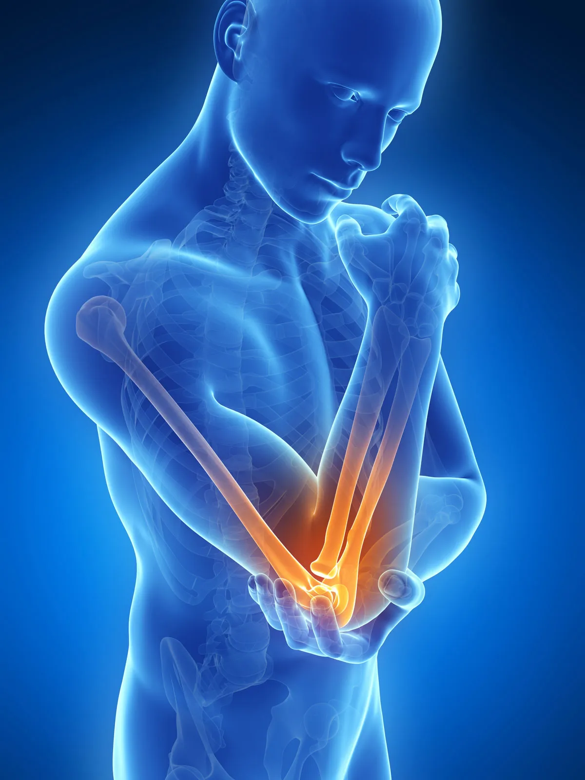 Tennis Elbow in Non-Tennis Players: Modern Causes and Solutions