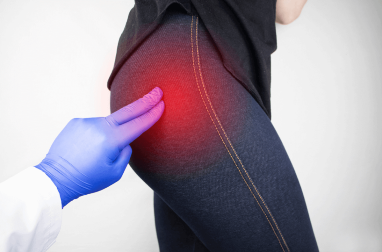 Sciatica or Just a Muscle Pull? Don’t Guess — Here’s What to Know
