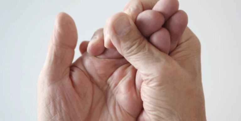 Numbness in Your Hands at Night? It’s Not Just ‘Sleeping Funny’ — It Could Be Carpal Tunnel